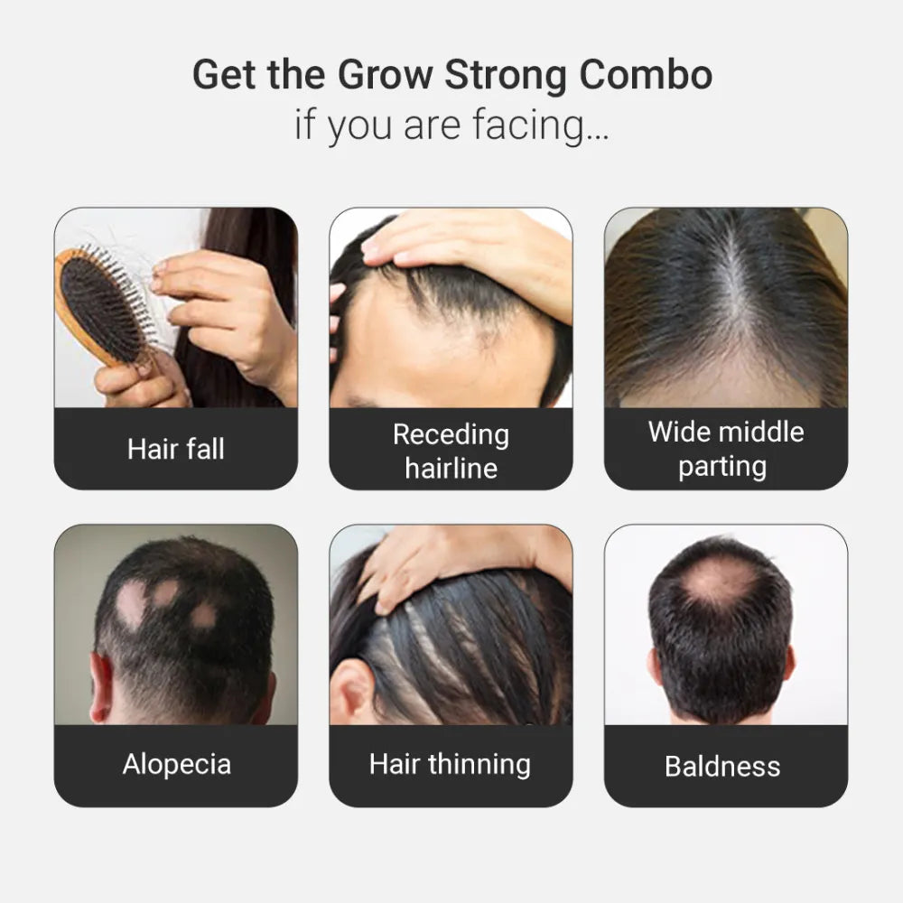 Grow Strong Combo - Super Shampoo 300ml + Serum 30ml - Free Derma Roller + Scalp Massager 300ml