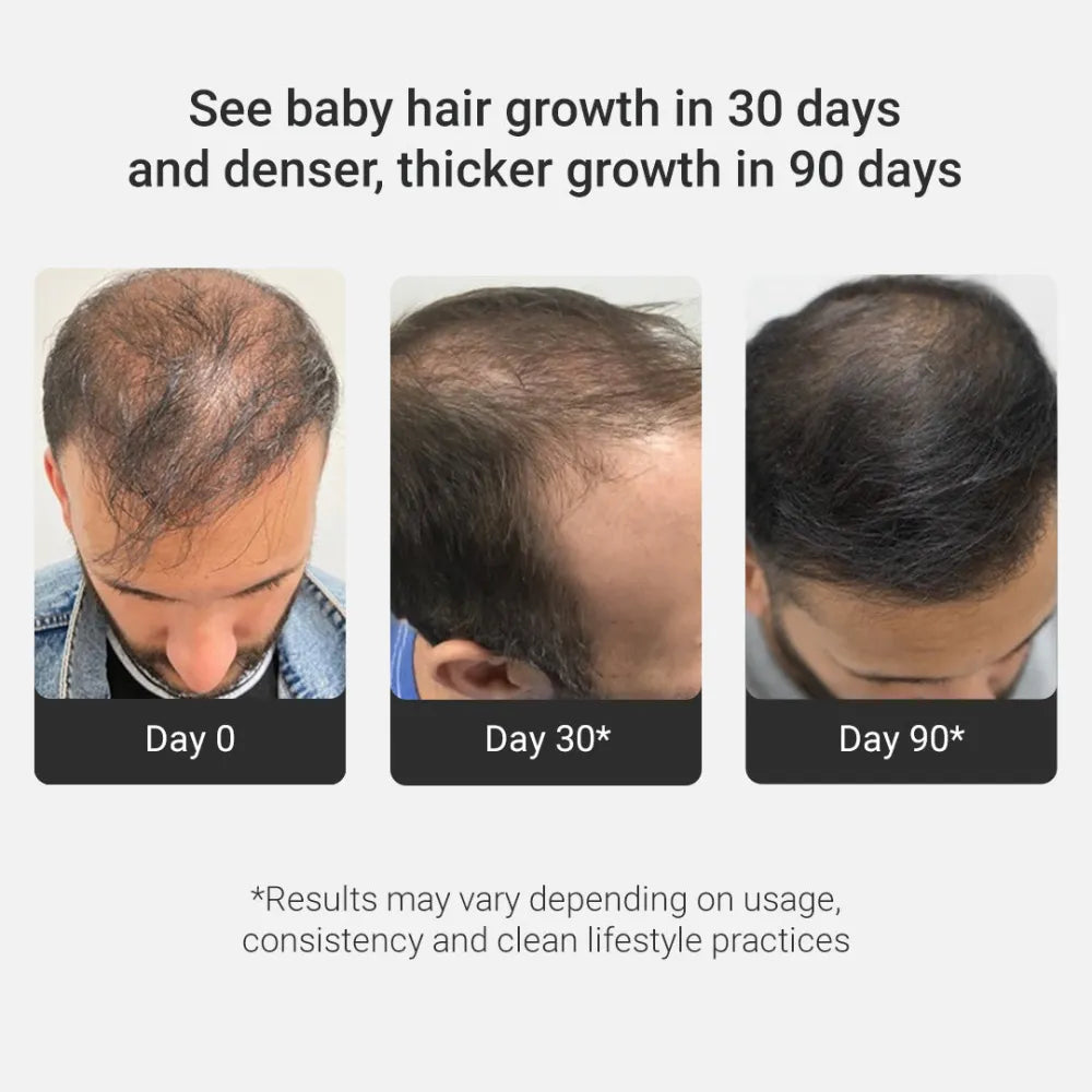 Grow Strong Combo - Super Shampoo 300ml + Serum 30ml - Free Derma Roller + Scalp Massager 300ml