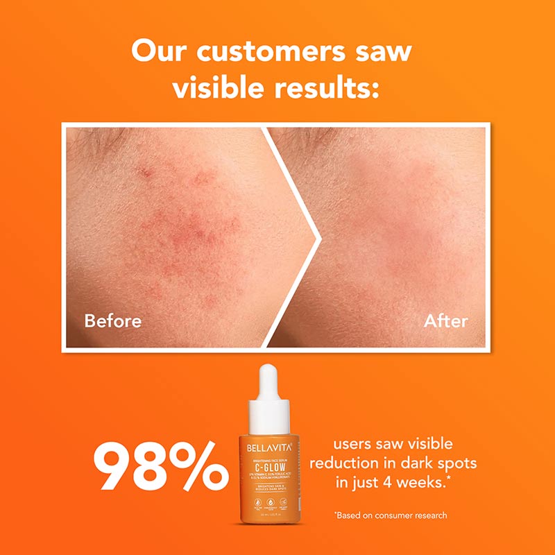 C-Glow 10% Vitamin C Serum - 30ml (Pack of 2) 30ml