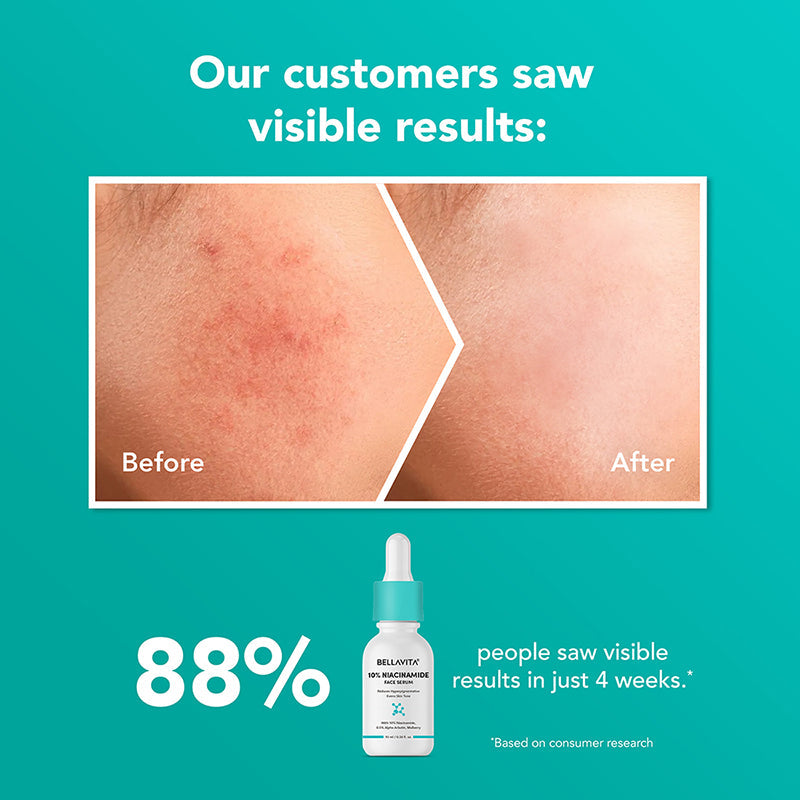 10% Niacinamide Face Serum - 10ml 10ml