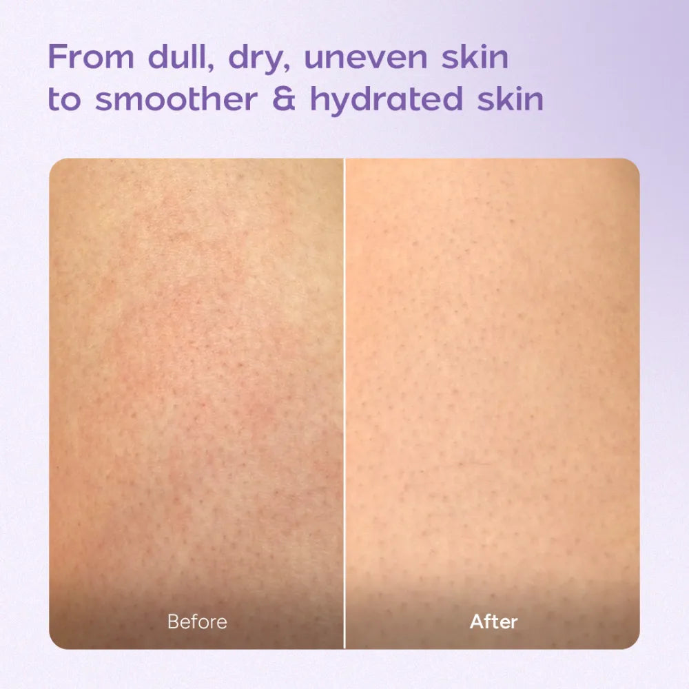 Niacinamide Body Milk for Dull and Dehydrated Skin 200 ml
