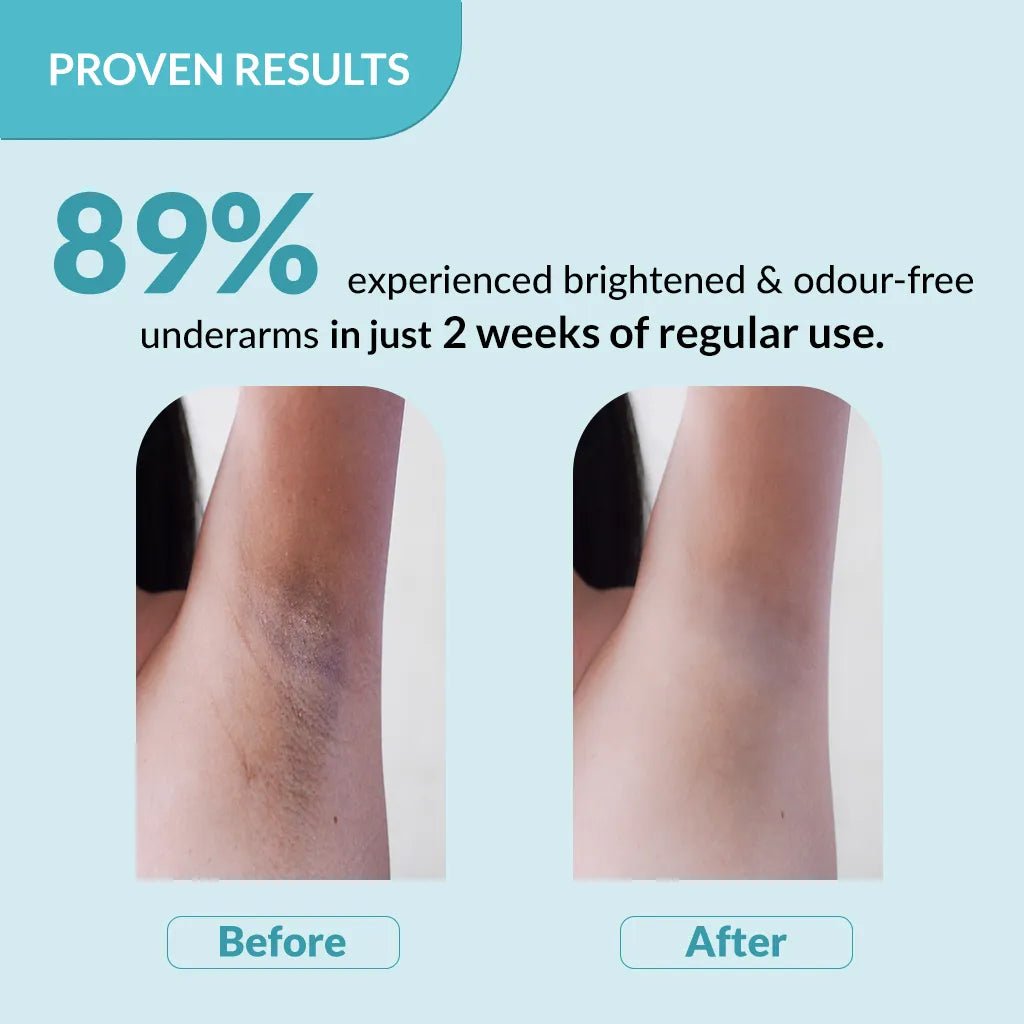 Nigrifix Underarm Lightening Roll On Ocean