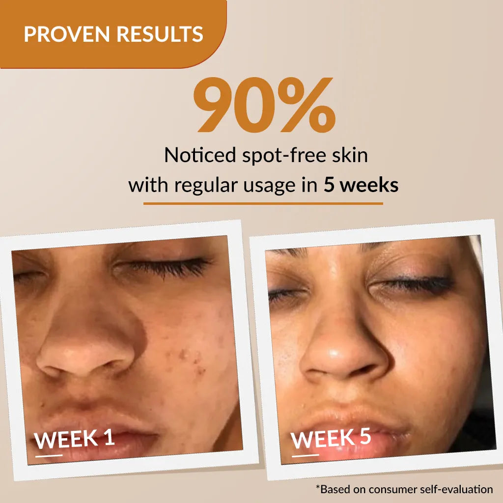 Skarfix-Plus Scar Removal Cream 30g