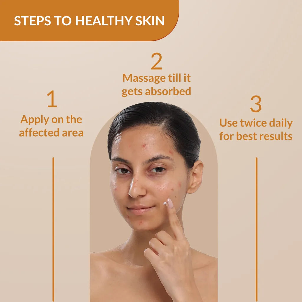Skarfix-Plus Scar Removal Cream 30g
